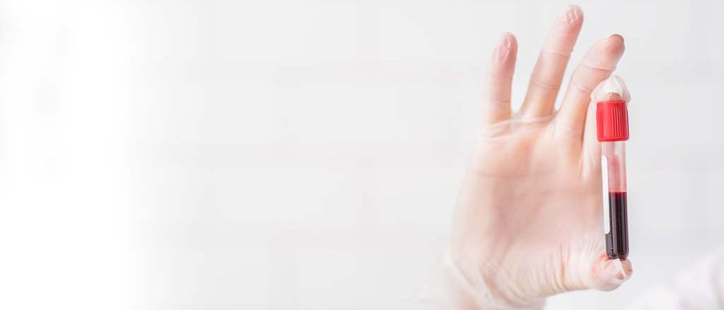 Komórki macierzyste